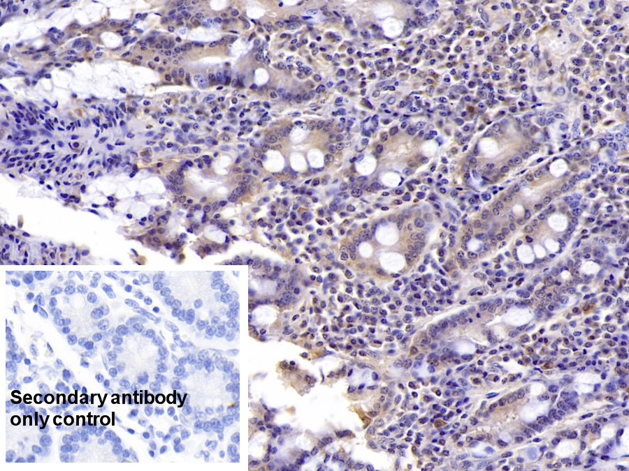 Monoclonal Antibody to Hedgehog Homolog, Sonic (SHH)