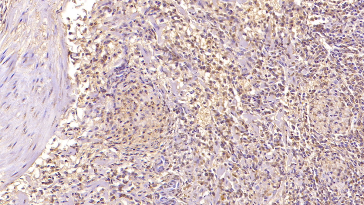 Monoclonal Antibody to Complement Factor D (CFD)