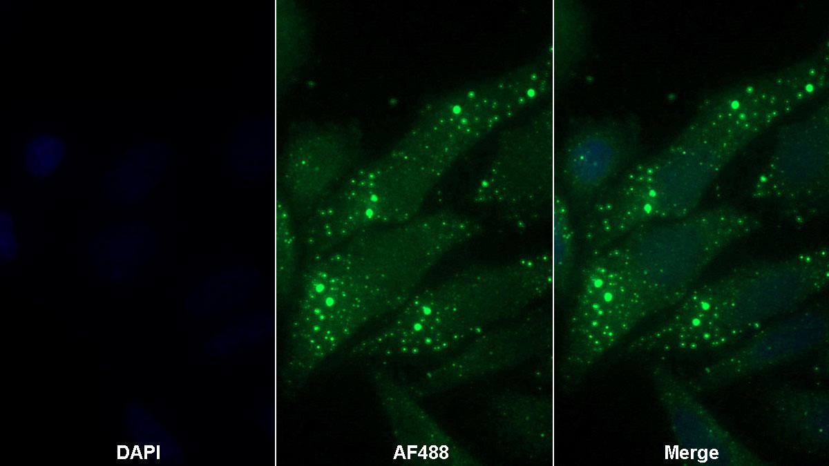 Monoclonal Antibody to Coagulation Factor XI (F11)