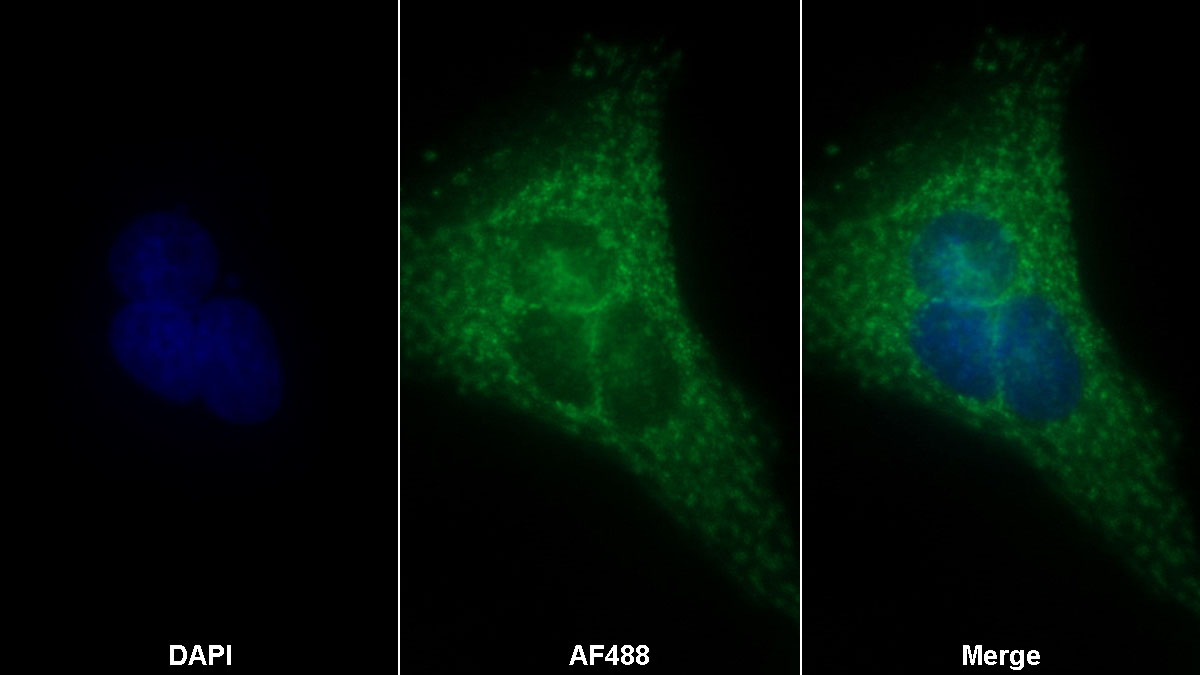 Monoclonal Antibody to Coagulation Factor XI (F11)