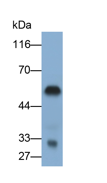 Monoclonal Antibody to Interleukin 2 Receptor Alpha (IL2Ra)