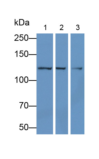 Monoclonal Antibody to Vinculin (VCL)