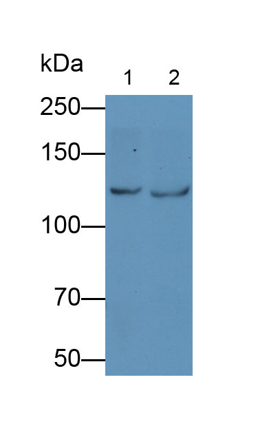 Monoclonal Antibody to Vinculin (VCL)