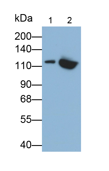 Monoclonal Antibody to Vinculin (VCL)