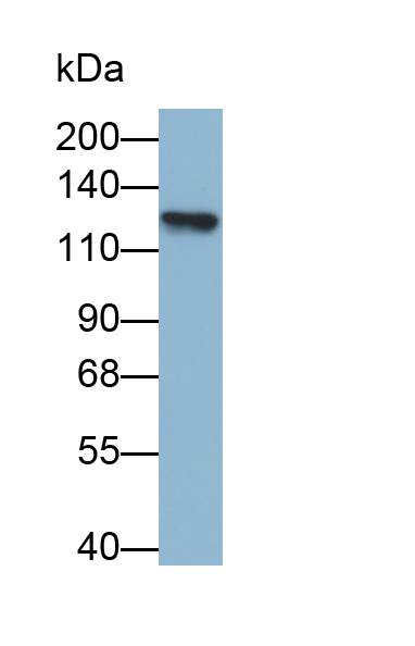 Monoclonal Antibody to Vinculin (VCL)