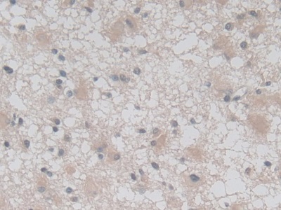 Monoclonal Antibody to Vascular Endothelial Growth Factor 121 (VEGF121)