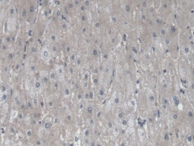 Monoclonal Antibody to Vascular Endothelial Growth Factor 121 (VEGF121)