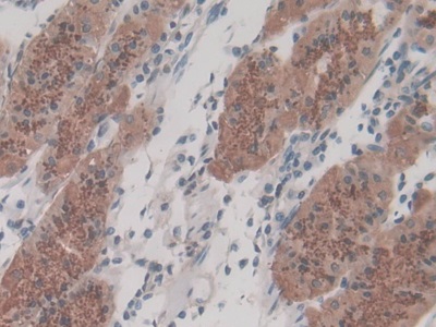 Monoclonal Antibody to Vascular Endothelial Growth Factor 121 (VEGF121)