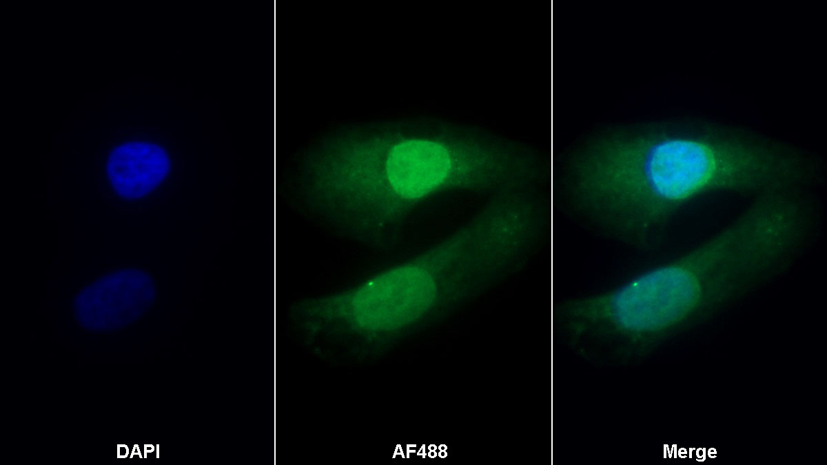 Monoclonal Antibody to Lectin Like Oxidized Low Density Lipoprotein Receptor 1 (LOX1)