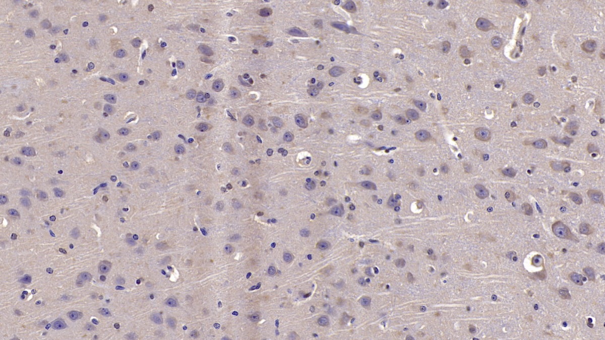 Monoclonal Antibody to Neuregulin 1 (NRG1)