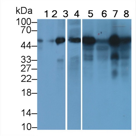 Monoclonal Antibody to Tubulin Beta (TUBb)