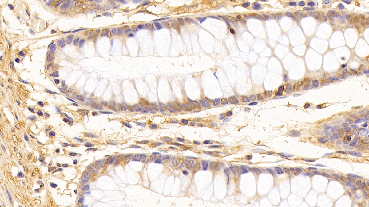 Monoclonal Antibody to Tubulin Beta (TUBb)