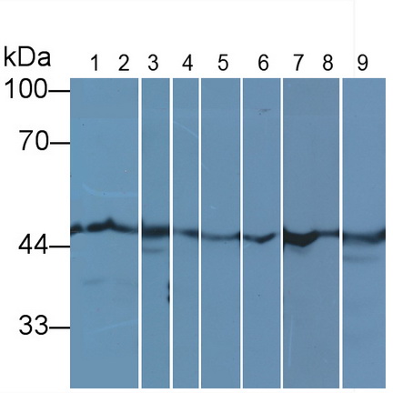 Monoclonal Antibody to Tubulin Beta (TUBb)