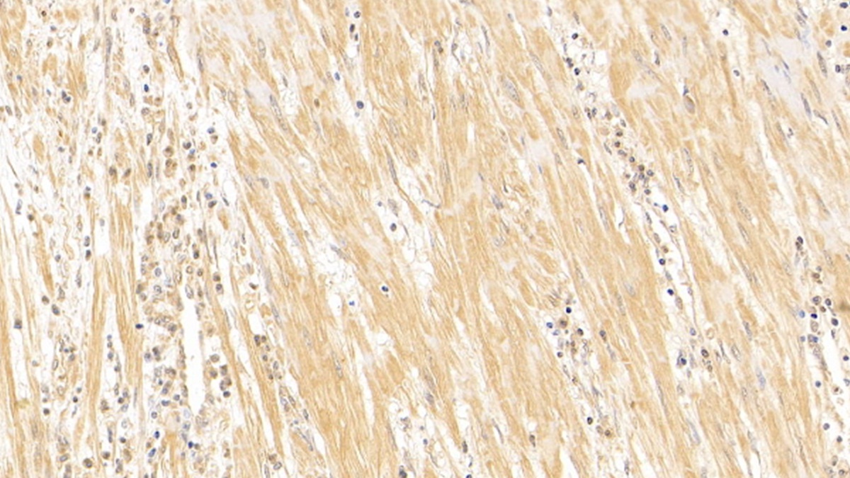 Monoclonal Antibody to Tubulin Beta (TUBb)