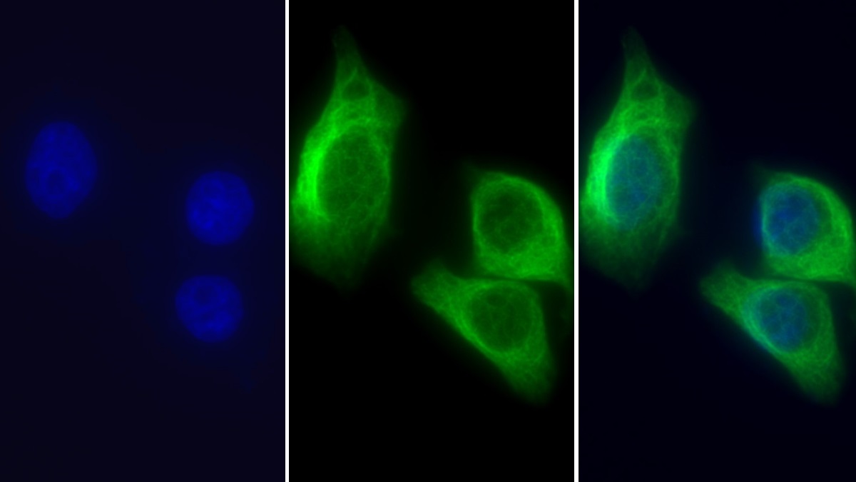 Monoclonal Antibody to Tubulin Beta (TUBb)