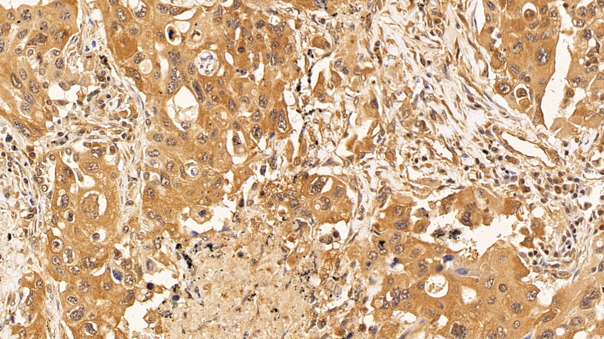 Monoclonal Antibody to Tubulin Beta (TUBb)