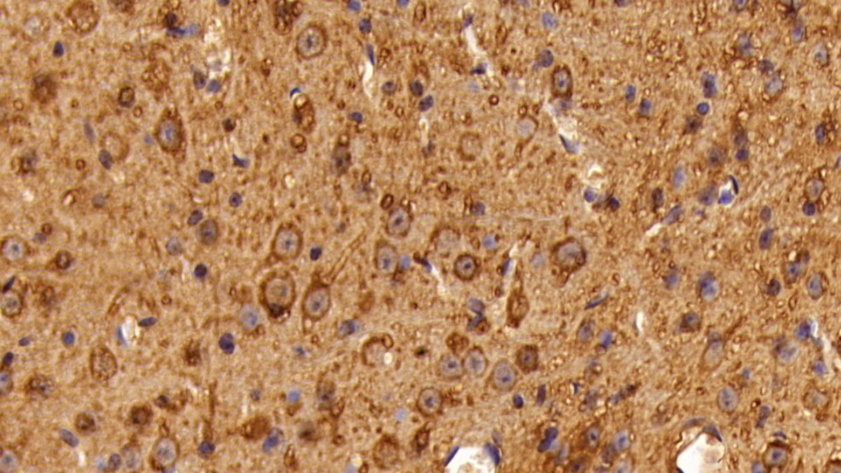 Monoclonal Antibody to Tubulin Beta (TUBb)