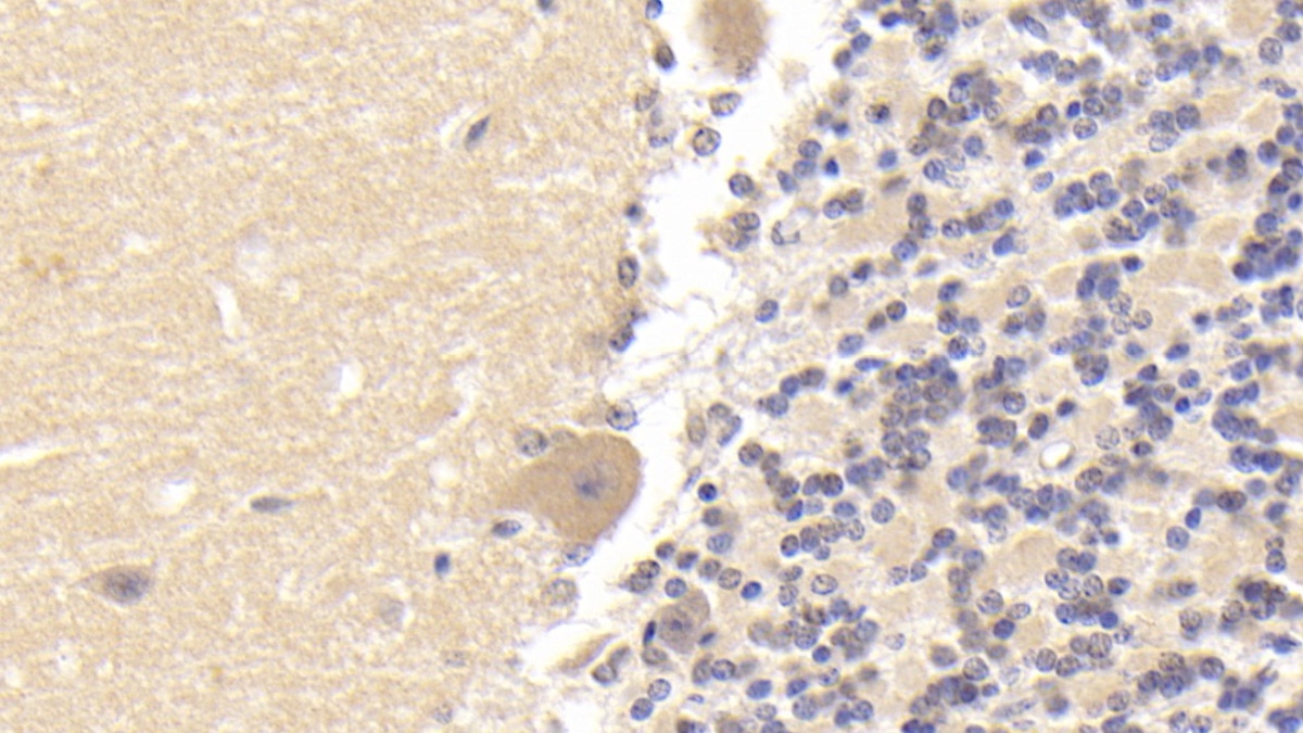 Monoclonal Antibody to Tubulin Beta (TUBb)