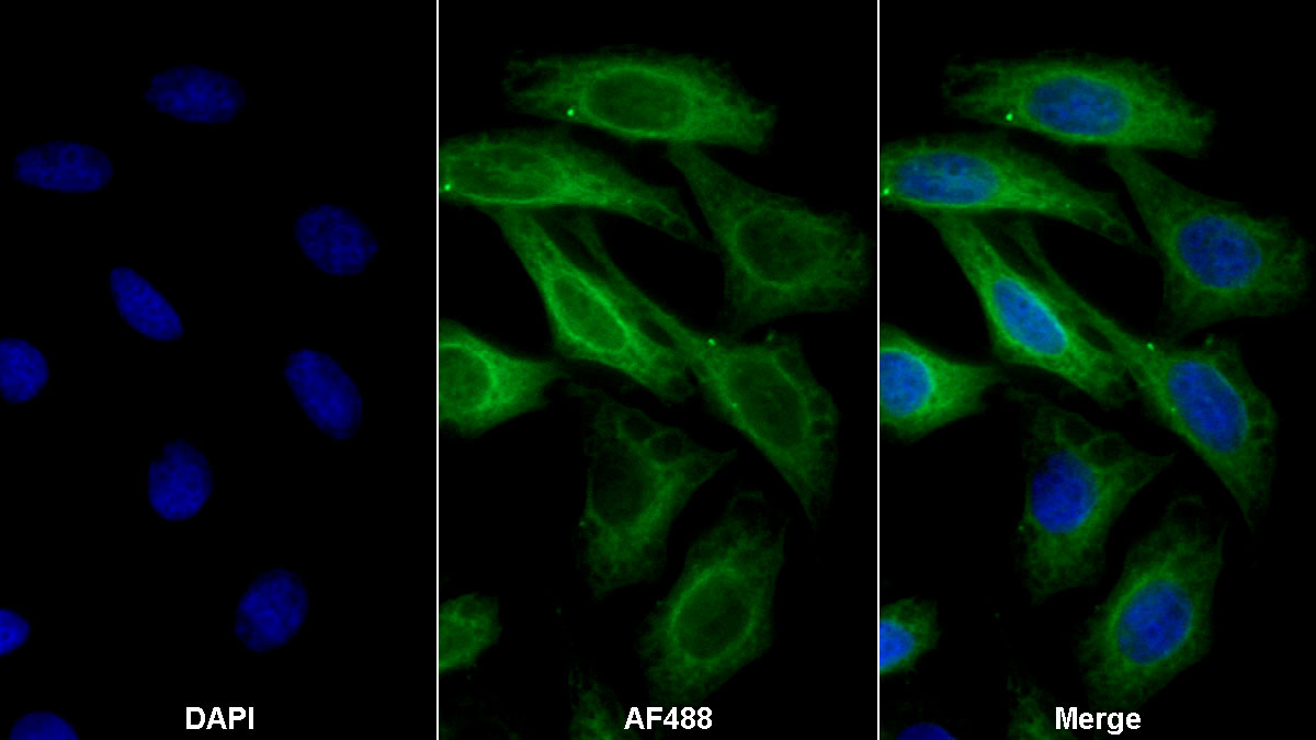 Monoclonal Antibody to Tubulin Beta (TUBb)