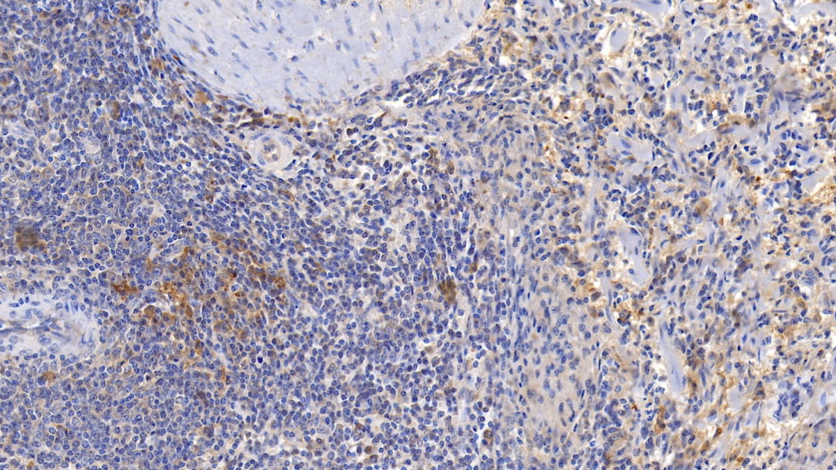 Monoclonal Antibody to Cluster Of Differentiation 3d (CD3d)