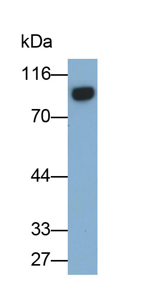 Monoclonal Antibody to Cluster Of Differentiation 19 (CD19)