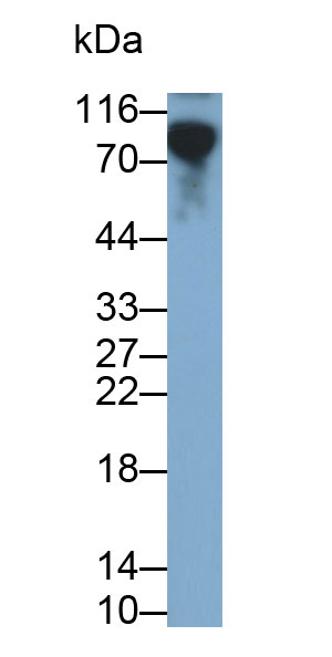 Monoclonal Antibody to Cluster Of Differentiation 19 (CD19)