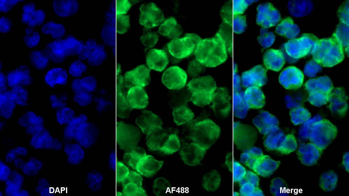 Monoclonal Antibody to Cluster Of Differentiation 19 (CD19)