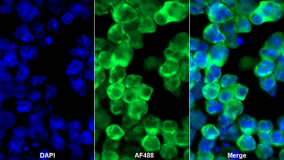 Monoclonal Antibody to Cluster Of Differentiation 19 (CD19)