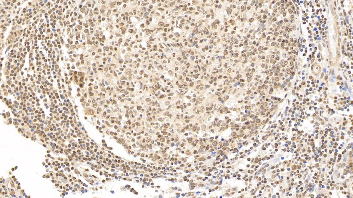 Monoclonal Antibody to Forkhead Box P3 (FOXP3)