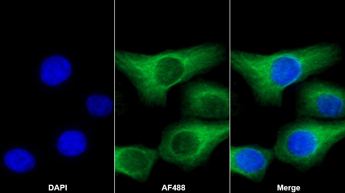 Monoclonal Antibody to Fibroblast Growth Factor 10 (FGF10)