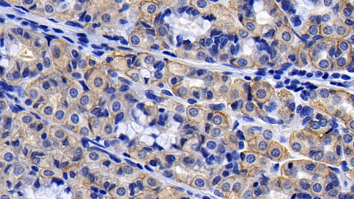 Monoclonal Antibody to Angiotensin I Converting Enzyme 2 (ACE2)