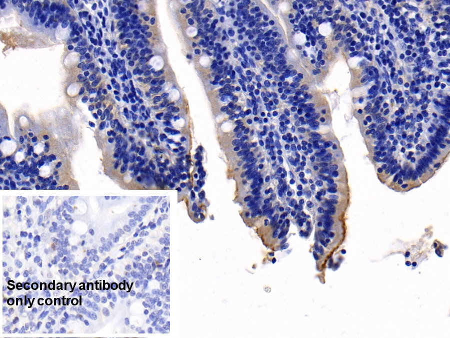 Monoclonal Antibody to Angiotensin I Converting Enzyme 2 (ACE2)