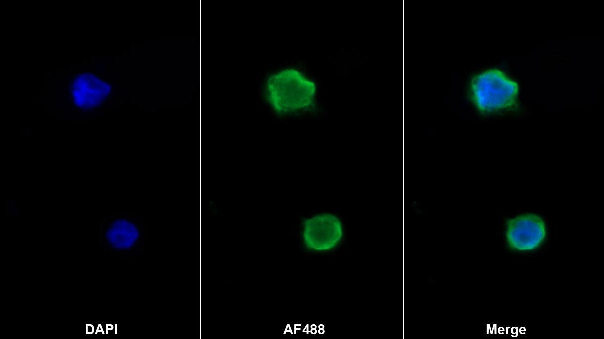 Monoclonal Antibody to Formyl Peptide Receptor 2 (FPR2)