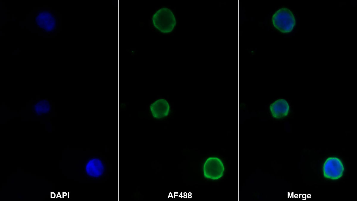 Monoclonal Antibody to Formyl Peptide Receptor 2 (FPR2)