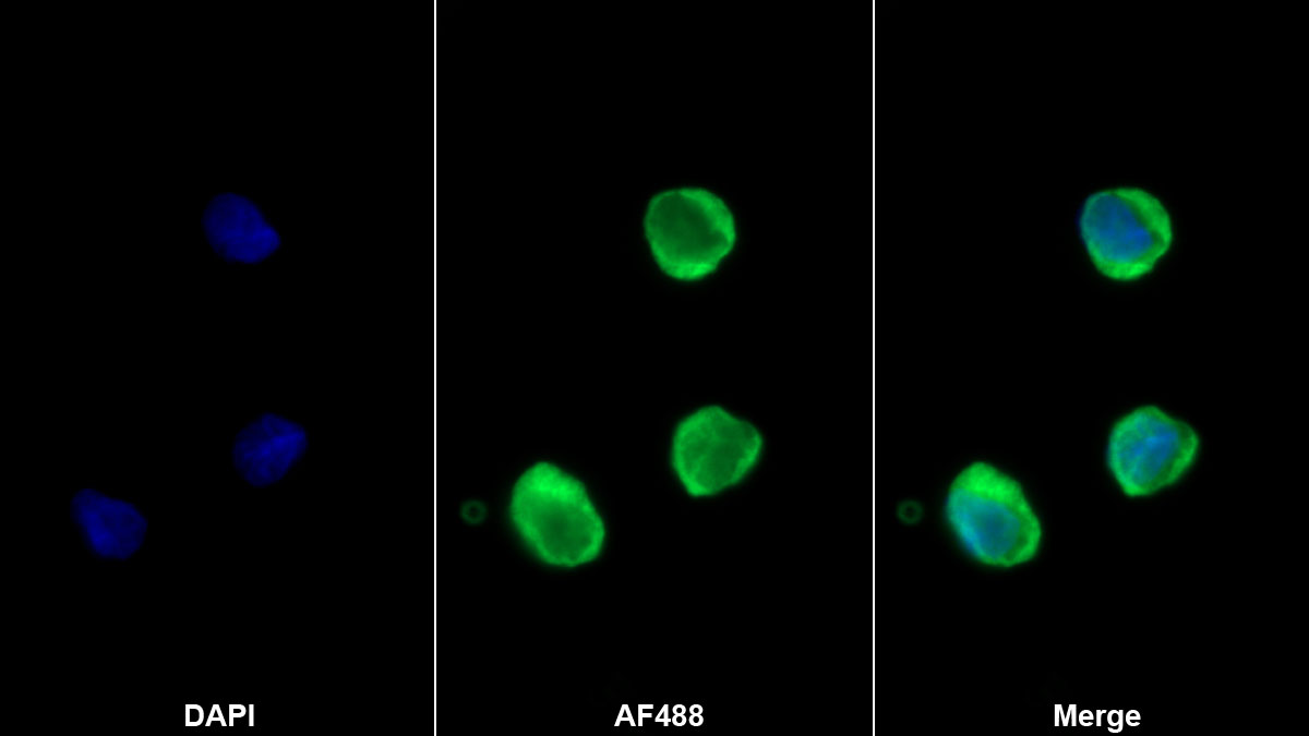 Monoclonal Antibody to Matrix Metalloproteinase 25 (MMP25)