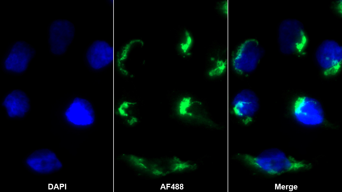 Monoclonal Antibody to Monokine Induced By Interferon Gamma (MIg)