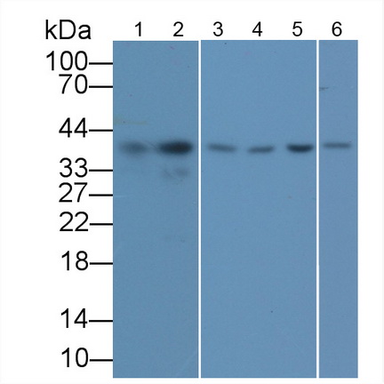 Monoclonal Antibody to Glyceraldehyde-3-Phosphate Dehydrogenase (GAPDH)