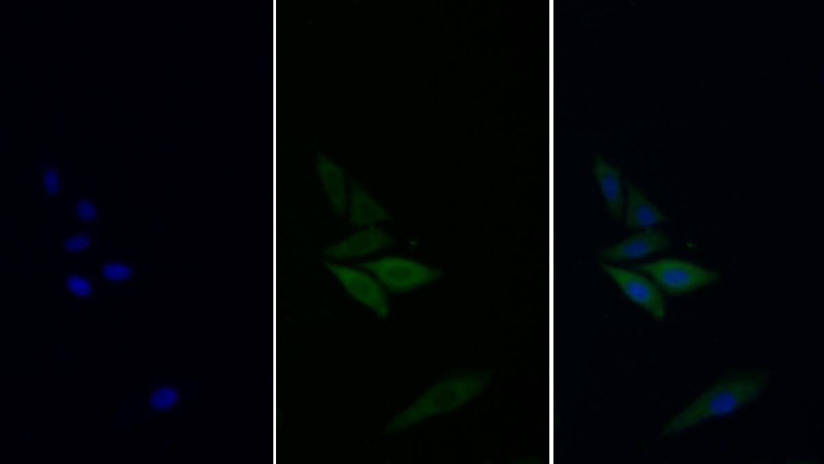 Monoclonal Antibody to Glyceraldehyde-3-Phosphate Dehydrogenase (GAPDH)