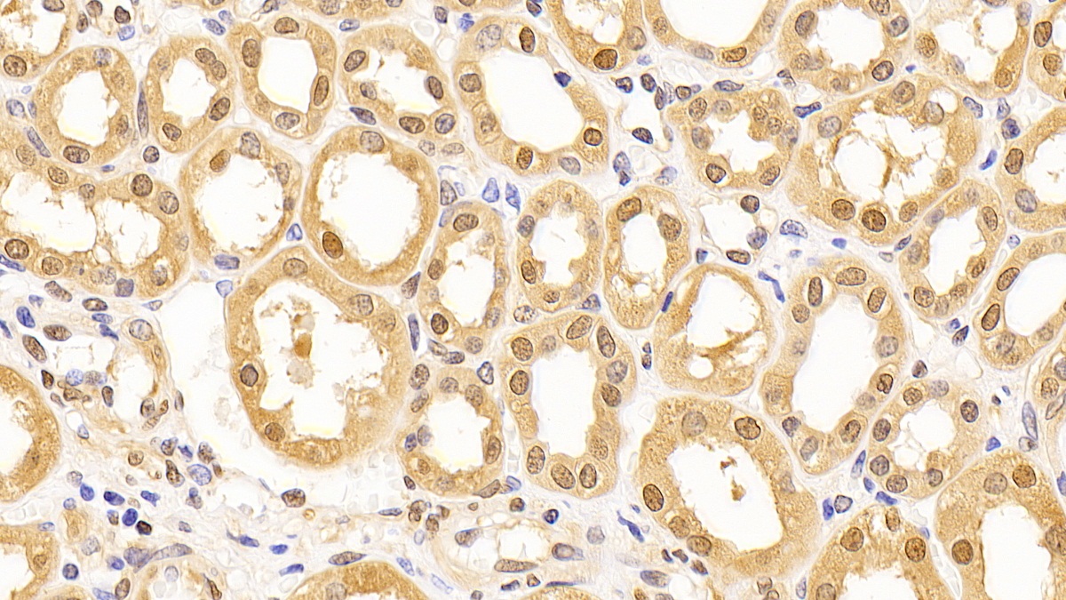 Monoclonal Antibody to Glyceraldehyde-3-Phosphate Dehydrogenase (GAPDH)