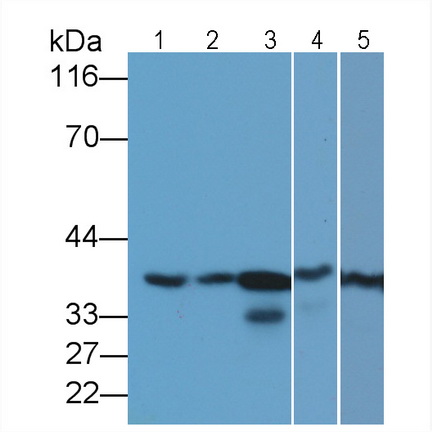 Monoclonal Antibody to Glyceraldehyde-3-Phosphate Dehydrogenase (GAPDH)