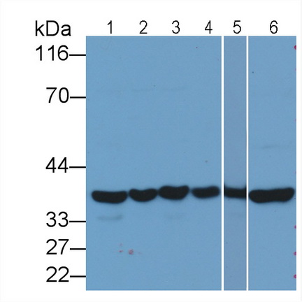 Monoclonal Antibody to Glyceraldehyde-3-Phosphate Dehydrogenase (GAPDH)