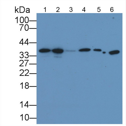 Monoclonal Antibody to Glyceraldehyde-3-Phosphate Dehydrogenase (GAPDH)