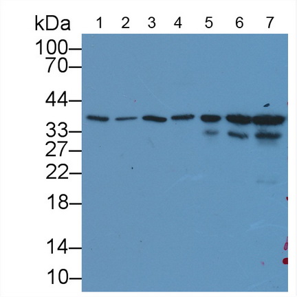 Monoclonal Antibody to Glyceraldehyde-3-Phosphate Dehydrogenase (GAPDH)