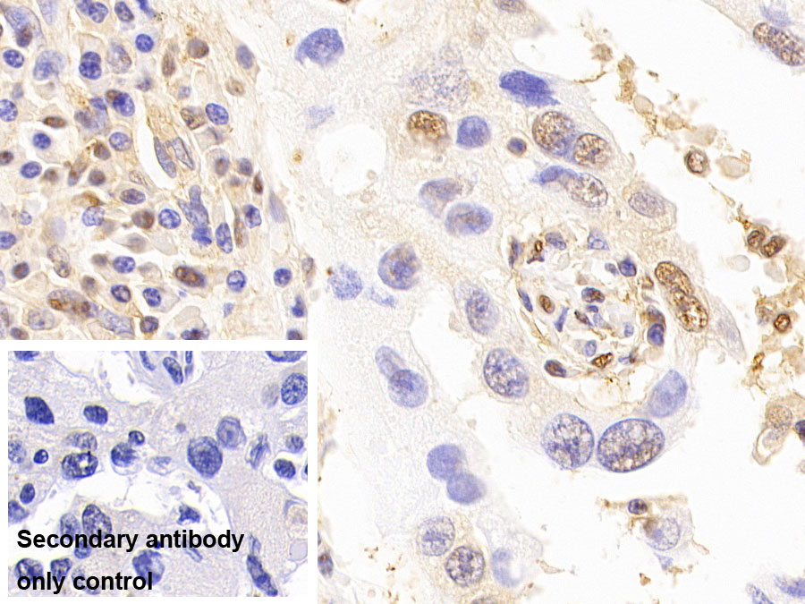 Monoclonal Antibody to Glyceraldehyde-3-Phosphate Dehydrogenase (GAPDH)