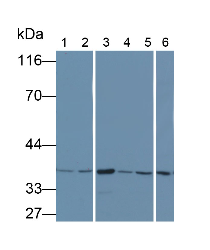 Monoclonal Antibody to Glyceraldehyde-3-Phosphate Dehydrogenase (GAPDH)