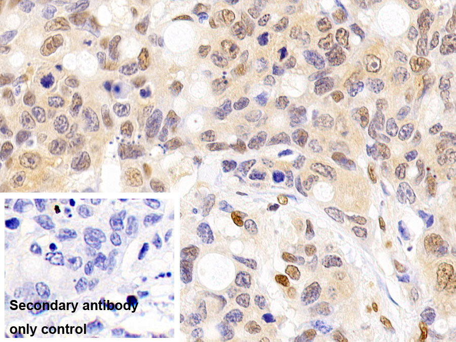 Monoclonal Antibody to Glyceraldehyde-3-Phosphate Dehydrogenase (GAPDH)