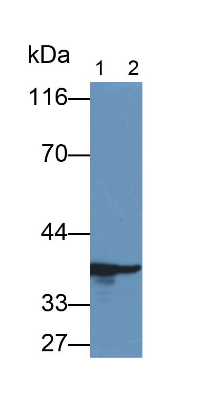 Monoclonal Antibody to Glyceraldehyde-3-Phosphate Dehydrogenase (GAPDH)