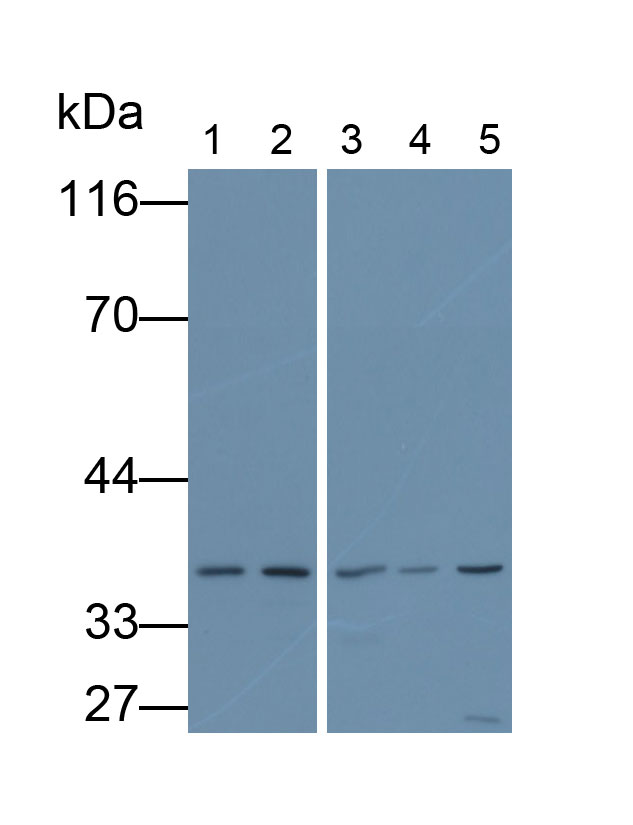 Monoclonal Antibody to Glyceraldehyde-3-Phosphate Dehydrogenase (GAPDH)