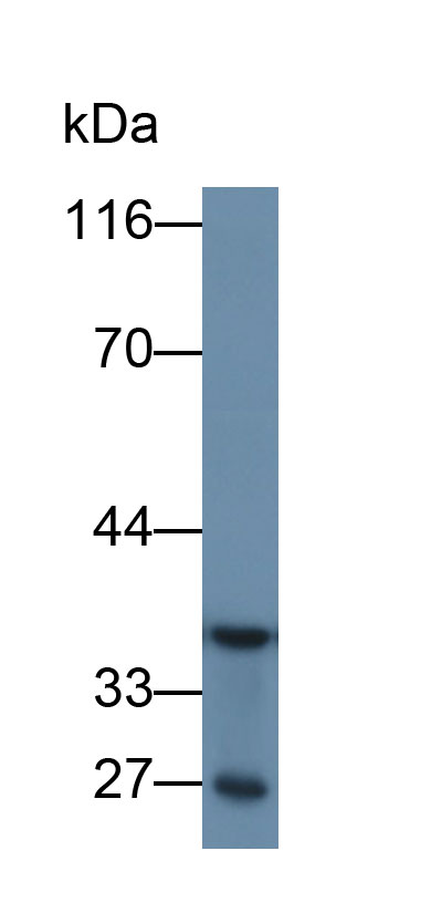 Monoclonal Antibody to Glyceraldehyde-3-Phosphate Dehydrogenase (GAPDH)