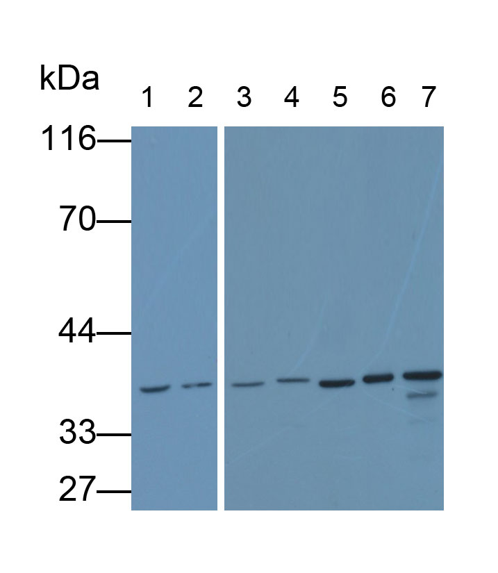 Monoclonal Antibody to Glyceraldehyde-3-Phosphate Dehydrogenase (GAPDH)